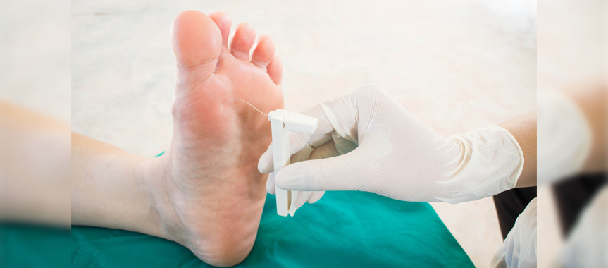 Диабетическая стопа